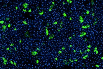 Liver chip aav expression