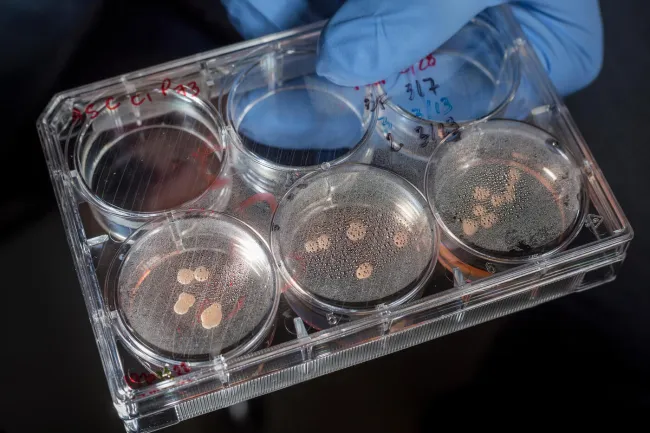 A tray of "minibrains," organoids used to study Neanderthal and modern human brains help to replace animal research methods